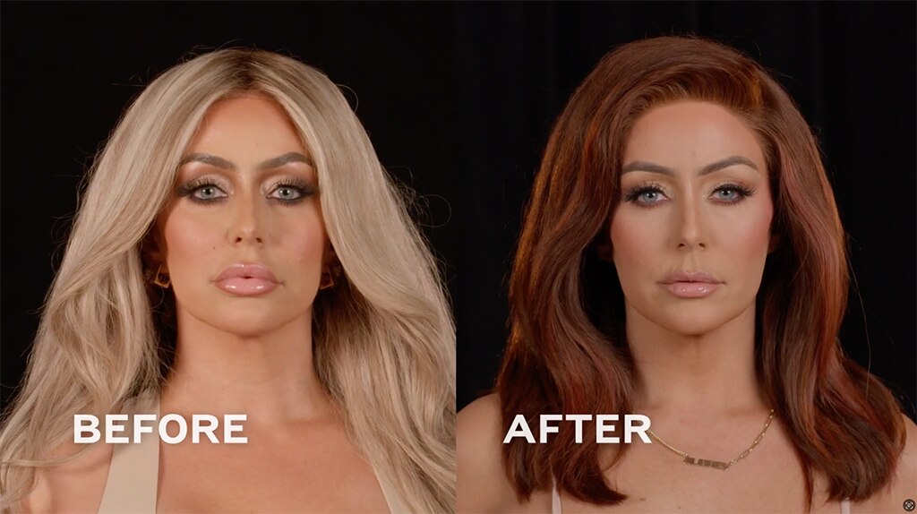 Botched Presents: Plastic Surgery Rewind Before & After Photos